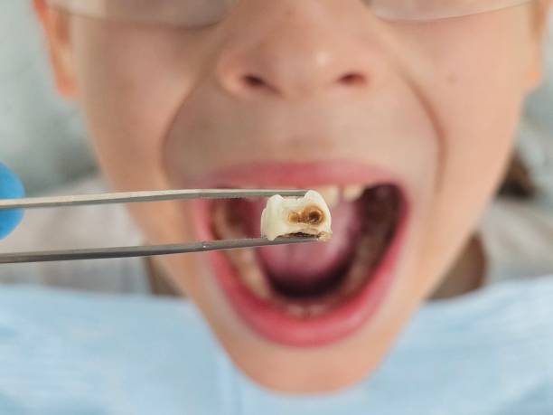 Best Pediatric Emergency Dentist in Compton, CA